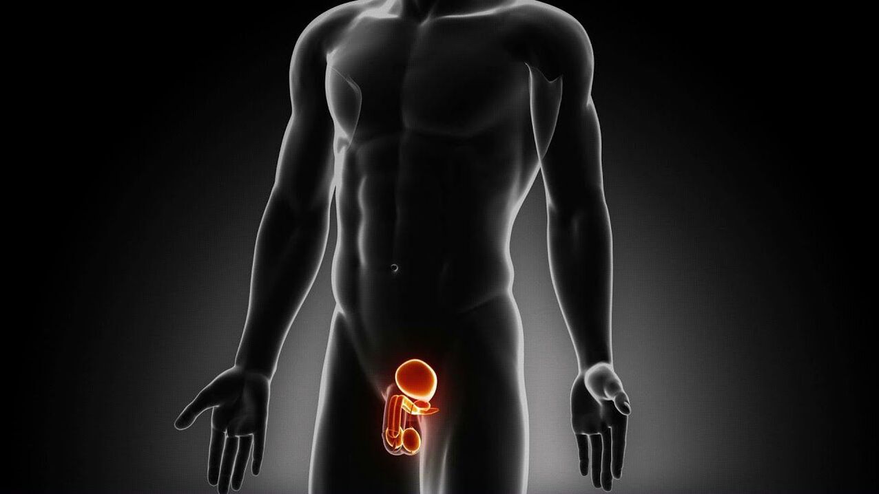 Falta de desexo sexual debido á impotencia