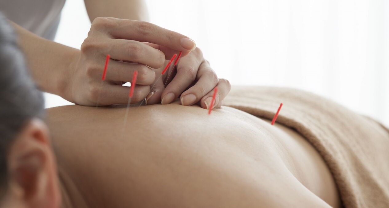 Acupuntura para aumentar a potencia